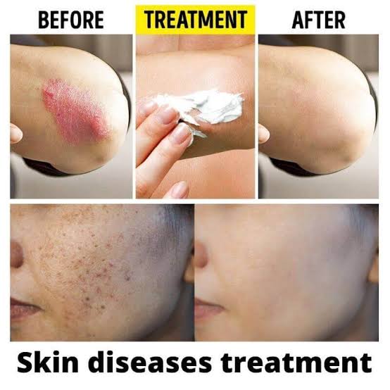 Dermatology Consultations