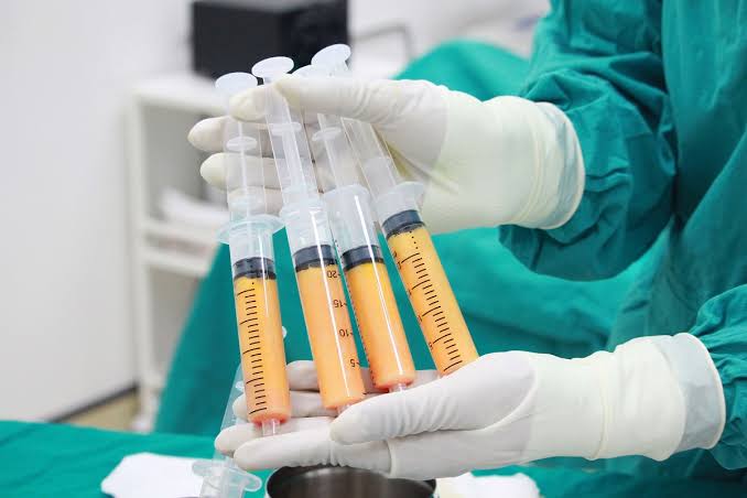 Fat Grafting / Autologous Fat Transfer