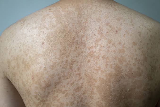 Skin & Laser Treatment