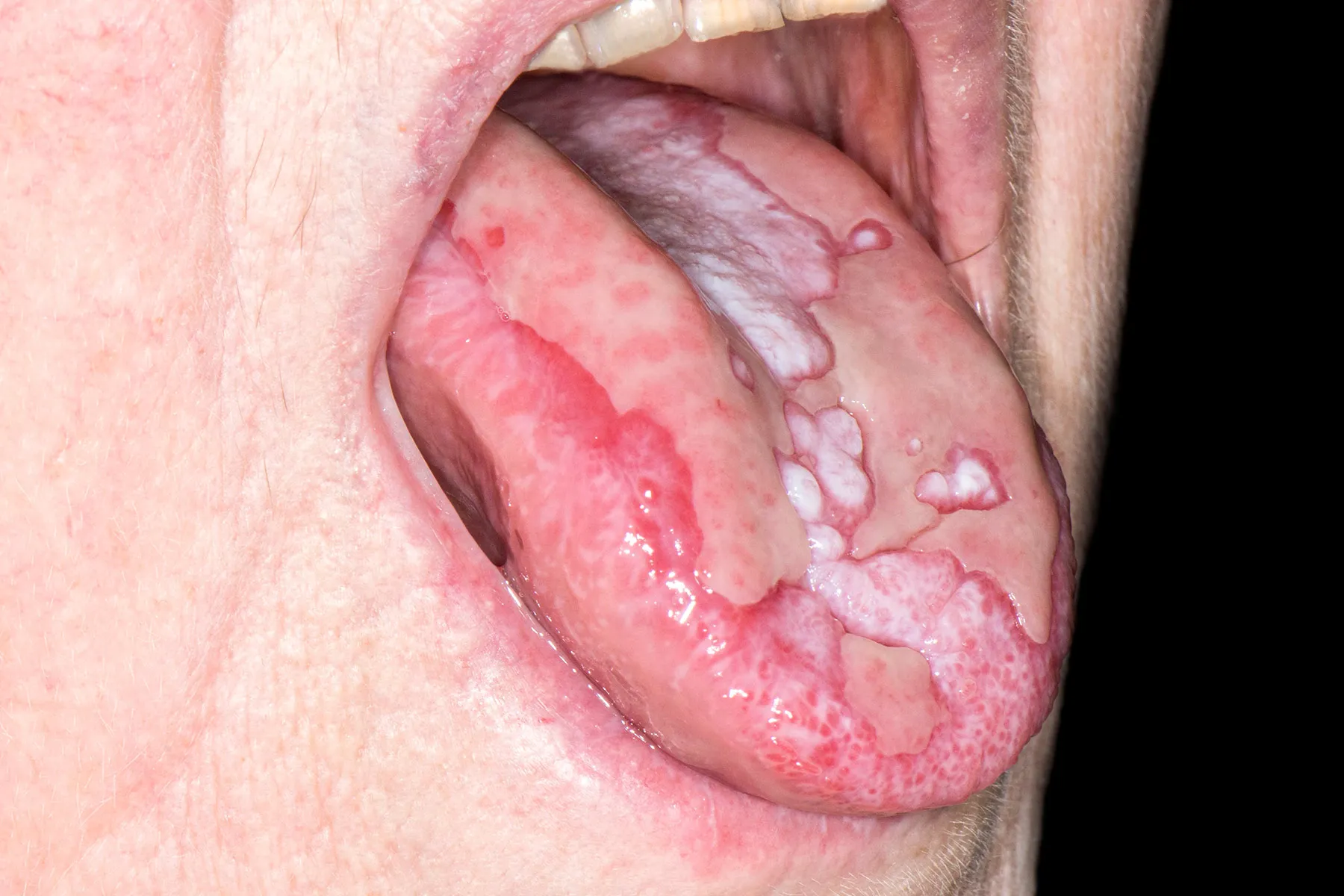Dermatology Care