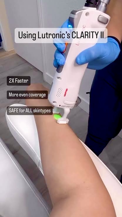 Laser Hair Removal