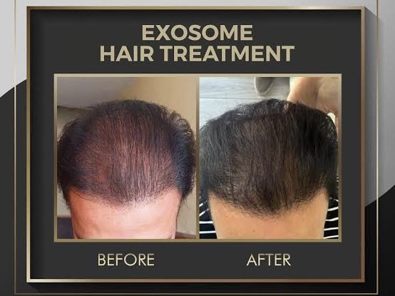 Hair Treatments